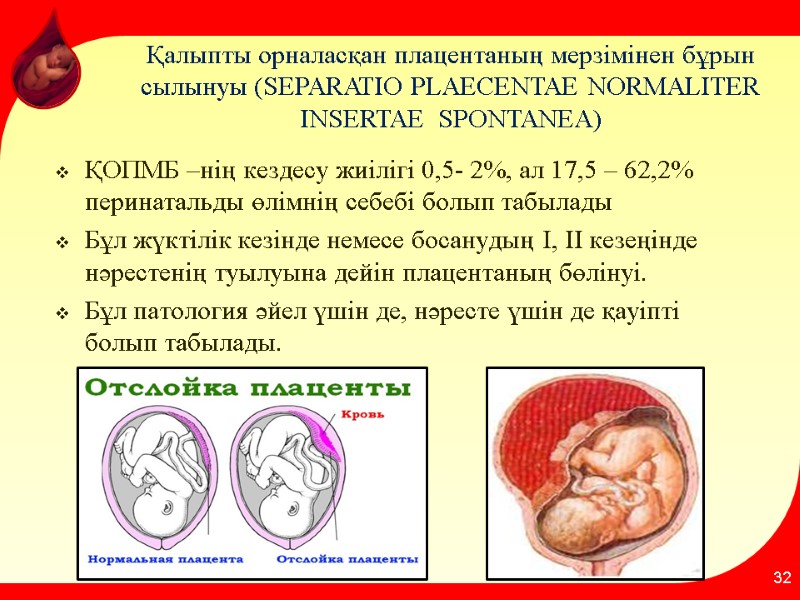 Қалыпты орналасқан плацентаның мерзімінен бұрын сылынуы (SEPARATIO PLAECENTAE NORMALITER INSERTAE  SPONTANEA) ҚОПМБ –нің